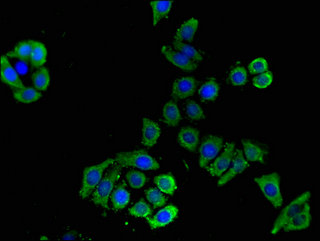 SLC16A9 Antibody - Immunofluorescent analysis of PC3 cells using SLC16A9 Antibody at a dilution of 1:100 and Alexa Fluor 488-congugated AffiniPure Goat Anti-Rabbit IgG(H+L)