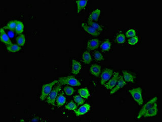 SLC16A9 Antibody - Immunofluorescent analysis of PC-3 cells using SLC16A9 Antibody at dilution of 1:100 and Alexa Fluor 488-congugated AffiniPure Goat Anti-Rabbit IgG(H+L)