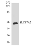 SLC17A2 Antibody - Western blot analysis of the lysates from RAW264.7cells using SLC17A2 antibody.