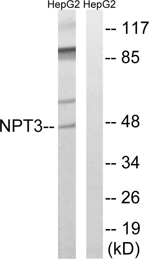 SLC17A2 Antibody - Western blot analysis of lysates from HepG2 cells, using SLC17A2 Antibody. The lane on the right is blocked with the synthesized peptide.