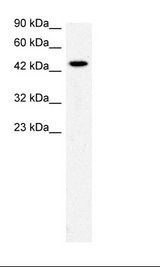 SLC17A2 Antibody - Jurkat Cell Lysate.  This image was taken for the unconjugated form of this product. Other forms have not been tested.