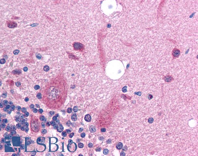 SLC17A2 Antibody - Anti-SLC17A2 antibody IHC of human brain-cerebellum. Immunohistochemistry of formalin-fixed, paraffin-embedded tissue after heat-induced antigen retrieval. Antibody concentration 5 ug/ml.  This image was taken for the unconjugated form of this product. Other forms have not been tested.