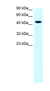 SLC17A2 Antibody - SLC17A2 antibody Western blot of Jurkat lysate. This image was taken for the unconjugated form of this product. Other forms have not been tested.