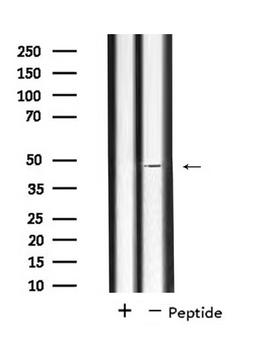 SLC17A2 Antibody - Western blot analysis of extracts of HepG2 cells using SLC17A2 antibody.