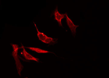 SLC17A2 Antibody - Staining HepG2 cells by IF/ICC. The samples were fixed with PFA and permeabilized in 0.1% Triton X-100, then blocked in 10% serum for 45 min at 25°C. The primary antibody was diluted at 1:200 and incubated with the sample for 1 hour at 37°C. An Alexa Fluor 594 conjugated goat anti-rabbit IgG (H+L) Ab, diluted at 1/600, was used as the secondary antibody.
