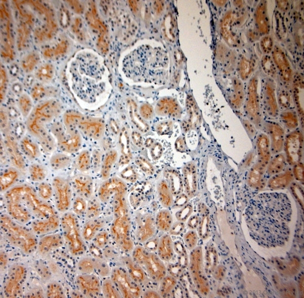 SLC17A3 Antibody - Rabbit antibody to SLC17A3 (2-50). IHC-P on paraffin sections of human kidney. HIER: Tris-EDTA, pH 9 for 20 min using Thermo PT Module. Blocking: 0.2% LFDM in TBST filtered through a 0.2 micron filter. Detection was done using Novolink HRP polymer from Leica following manufacturers instructions. Primary antibody: dilution 1:1000, incubated 30 min at RT using Autostainer. Sections were counterstained with Harris Hematoxylin.