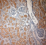 SLC17A3 Antibody - Rabbit antibody to SLC17A3 (2-50). IHC-P on paraffin sections of human kidney. HIER: Tris-EDTA, pH 9 for 20 min using Thermo PT Module. Blocking: 0.2% LFDM in TBST filtered through a 0.2 micron filter. Detection was done using Novolink HRP polymer from Leica following manufacturers instructions. Primary antibody: dilution 1:1000, incubated 30 min at RT using Autostainer. Sections were counterstained with Harris Hematoxylin.