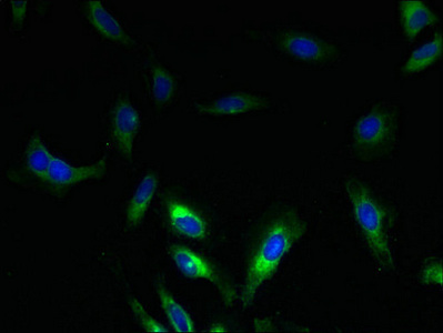 SLC17A3 Antibody - Immunofluorescent analysis of Hela cells using SLC17A3 Antibody at dilution of 1:100 and Alexa Fluor 488-congugated AffiniPure Goat Anti-Rabbit IgG(H+L)