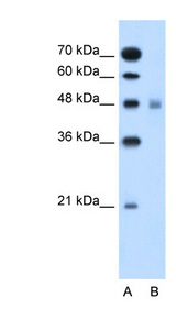 SLC17A4 Antibody - SLC17A4 antibody ARP43906_P050-NP_005486-SLC17A4(solute carrier family 17 (sodium phosphate), member 4) Antibody Western blot of Jurkat lysate.  This image was taken for the unconjugated form of this product. Other forms have not been tested.