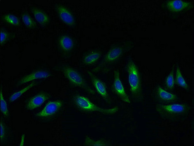 SLC17A4 Antibody - Immunofluorescent analysis of Hela cells using SLC17A4 Antibody at dilution of 1:100 and Alexa Fluor 488-congugated AffiniPure Goat Anti-Rabbit IgG(H+L)