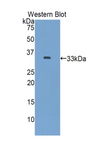 SLC17A5 Antibody - Western blot of recombinant SLC17A5.  This image was taken for the unconjugated form of this product. Other forms have not been tested.