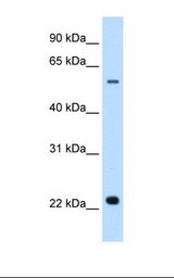 SLC17A5 Antibody - Transfected 293T cell lysate. Antibody concentration: 0.5 ug/ml. Gel concentration: 12%.  This image was taken for the unconjugated form of this product. Other forms have not been tested.
