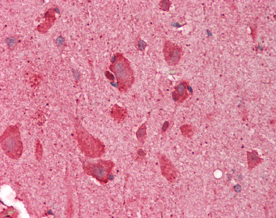 SLC17A5 Antibody - Human Brain, Cortex: Formalin-Fixed, Paraffin-Embedded (FFPE).  This image was taken for the unconjugated form of this product. Other forms have not been tested.