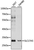 SLC17A5 Antibody - Western blot analysis of extracts of various cell lines, using SLC17A5 antibody at 1:1000 dilution. The secondary antibody used was an HRP Goat Anti-Rabbit IgG (H+L) at 1:10000 dilution. Lysates were loaded 25ug per lane and 3% nonfat dry milk in TBST was used for blocking. An ECL Kit was used for detection and the exposure time was 60s.