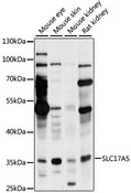 SLC17A5 Antibody - Western blot analysis of extracts of various cell lines, using SLC17A5 antibody at 1:1000 dilution. The secondary antibody used was an HRP Goat Anti-Rabbit IgG (H+L) at 1:10000 dilution. Lysates were loaded 25ug per lane and 3% nonfat dry milk in TBST was used for blocking. An ECL Kit was used for detection and the exposure time was 60s.