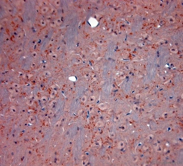 SLC17A6 / VGLUT2 Antibody - IHC-P on paraffin sections of mouse brain. The animal was perfused using Autoperfuser at a pressure of 130 mmHg with 200 ml 4% FA before being processed for paraffin embedding. HIER: Tris-EDTA, pH 9 for 20 min using Thermo PT Module. Blocking: 0.2% LFDM in TBST filtered through 0.2 µm. Detection was done using Novolink HRP polymer from Leica following manufacturers instructions; DAB chromogen: Candela DAB chromogen. Primary antibody: dilution 1:500, incubated 30 min at RT using Autostainer. Sections were counterstained with Harris Hematoxylin.