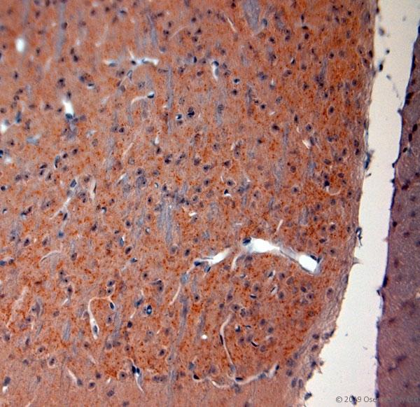 SLC17A6 / VGLUT2 Antibody - IHC-P on paraffin sections of rat brain. The animal was perfused using Autoperfuser at a pressure of 130 mmHg with 200 ml 4% FA before being processed for paraffin embedding. HIER: Tris-EDTA, pH 9 for 20 min using Thermo PT Module. Blocking: 0.2% LFDM in TBST filtered through 0.2 µm. Detection was done using Novolink HRP polymer from Leica following manufacturers instructions; DAB chromogen: Candela DAB chromogen. Primary antibody: dilution 1:500, incubated 30 min at RT using Autostainer. Sections were counterstained with Harris Hematoxylin.