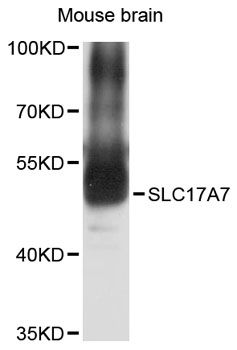 SLC17A7 / VGLUT1 Antibody - Western blot analysis of extracts of mouse brain, using SLC17A7 antibody at 1:3000 dilution. The secondary antibody used was an HRP Goat Anti-Rabbit IgG (H+L) at 1:10000 dilution. Lysates were loaded 25ug per lane and 3% nonfat dry milk in TBST was used for blocking. An ECL Kit was used for detection and the exposure time was 30s.
