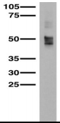 SLC17A7 / VGLUT1 Antibody - Adult rat brain immunoblot