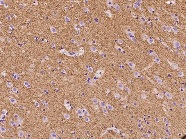 SLC17A7 / VGLUT1 Antibody - Immunochemical staining of human SLC17A7 in human brain with rabbit polyclonal antibody at 1:100 dilution, formalin-fixed paraffin embedded sections.