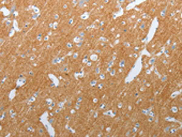 SLC17A7 / VGLUT1 Antibody - Immunohistochemistry of paraffin-embedded Human brain tissue  using SLC17A7 Polyclonal Antibody at dilution of 1:200(×200)