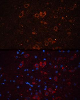 SLC17A7 / VGLUT1 Antibody - Immunofluorescence analysis of Mouse brain using SLC17A7 Polyclonal Antibody at dilution of 1:100.Blue: DAPI for nuclear staining.