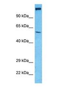 SLC17A7 / VGLUT1 Antibody - Western blot of VGLU1 Antibody with human HepG2 Whole Cell lysate.  This image was taken for the unconjugated form of this product. Other forms have not been tested.
