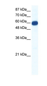 SLC18A1 / VMAT1 Antibody - SLC18A1 / VMAT1 antibody Western blot of Jurkat lysate. This image was taken for the unconjugated form of this product. Other forms have not been tested.
