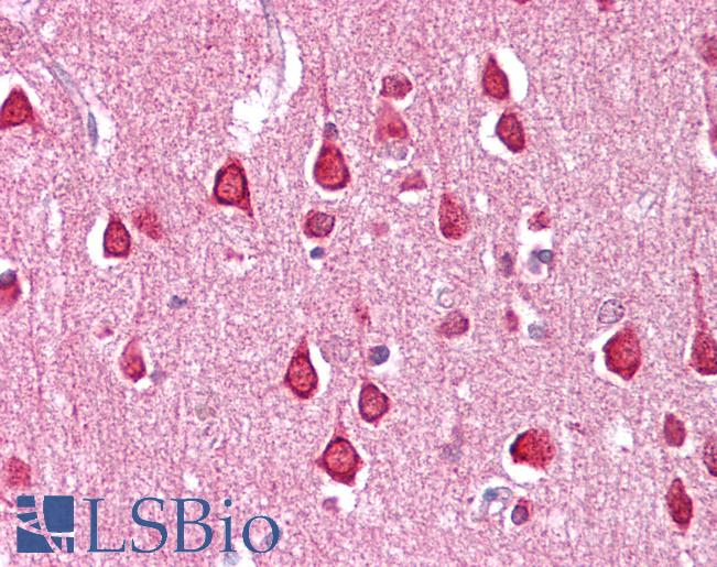 SLC18A1 / VMAT1 Antibody - Anti-SLC18A1 / VMAT1 antibody IHC of human brain-cortex. Immunohistochemistry of formalin-fixed, paraffin-embedded tissue after heat-induced antigen retrieval. Antibody concentration 2.5 ug/ml.  This image was taken for the unconjugated form of this product. Other forms have not been tested.