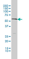 SLC18A1 / VMAT1 Antibody - SLC18A1 monoclonal antibody (M01), clone 3A2-E10 Western Blot analysis of SLC18A1 expression in A-549.