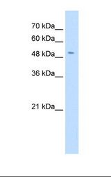 SLC18A2 / VMAT2 Antibody - Jurkat cell lysate. Antibody concentration: 0.5 ug/ml. Gel concentration: 12%.  This image was taken for the unconjugated form of this product. Other forms have not been tested.