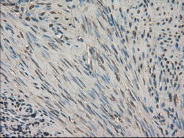 SLC18A2 / VMAT2 Antibody - IHC of paraffin-embedded endometrium tissue using anti-SLC18A2 mouse monoclonal antibody. (Dilution 1:50).