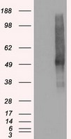 SLC18A2 / VMAT2 Antibody - HEK293T cells were transfected with the pCMV6-ENTRY control (Left lane) or pCMV6-ENTRY SLC18A2 (Right lane) cDNA for 48 hrs and lysed. Equivalent amounts of cell lysates (5 ug per lane) were separated by SDS-PAGE and immunoblotted with anti-SLC18A2.