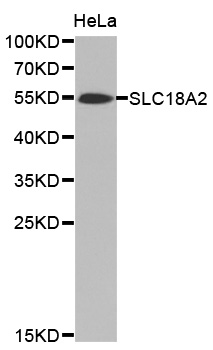 SLC18A2 / VMAT2 Antibody - Western blot analysis of extracts of HeLa cell line, using SLC18A2 antibody.
