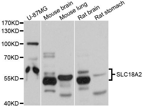 SLC18A2 / VMAT2 Antibody - Western blot analysis of extracts of various cells.