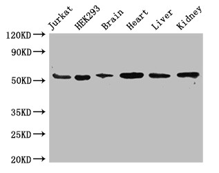 SLC18A2 / VMAT2 Antibody - Positive WB detected in:Jurkat whole cell lysate,HEK293 whole cell lysate,Mouse brain tissue,Mouse heart tissue,Mouse liver tissue,Mouse kidney tissue;All lanes:SLC18A2 antibody at 3.4?g/ml;Secondary;Goat polyclonal to rabbit IgG at 1/50000 dilution;Predicted band size: 56,23 KDa;Observed band size: 56 KDa;