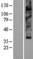 SLC18A2 / VMAT2 Protein - Western validation with an anti-DDK antibody * L: Control HEK293 lysate R: Over-expression lysate