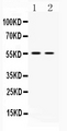 SLC18A3 / VACHT Antibody - Western blot - Anti-SLC18A3/Vacht Picoband Antibody