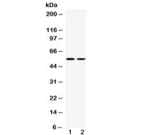 SLC18A3 / VACHT Antibody - Western blot testing of 1) human HeLa and 2) mouse HEPA cell lysate with VAChT antibody at 0.5ug/ml. Predicted molecular weight ~57 kDa.
