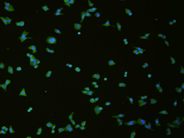 SLC18A3 / VACHT Antibody - Immunofluorescence analysis of hela cell  using SLC18A3 Polyclonal Antibody at dilution of 1:50