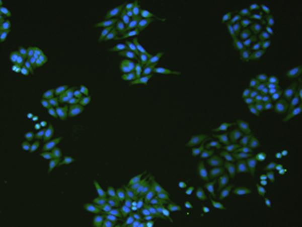 SLC18A3 / VACHT Antibody - Immunofluorescence analysIs of HepG2 cell  using SLC18A3 Polyclonal Antibody at dilution of 1:50