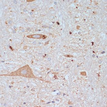 SLC18A3 / VACHT Antibody - Immunohistochemistry of paraffin-embedded Rat brain using SLC18A3 Polyclonal Antibody at dilution of 1:200 (40x lens).