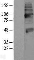 SLC18A3 / VACHT Protein - Western validation with an anti-DDK antibody * L: Control HEK293 lysate R: Over-expression lysate