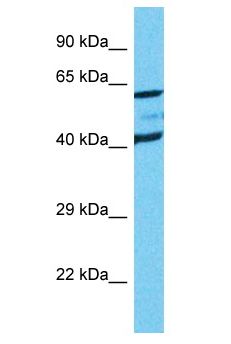 SLC19A1 Antibody - SLC19A1 antibody Western Blot of Jurkat. Antibody dilution: 1 ug/ml.  This image was taken for the unconjugated form of this product. Other forms have not been tested.
