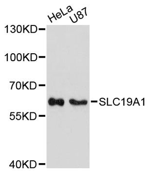 SLC19A1 Antibody - Western blot analysis of extracts of various cell lines, using SLC19A1 antibody at 1:3000 dilution. The secondary antibody used was an HRP Goat Anti-Rabbit IgG (H+L) at 1:10000 dilution. Lysates were loaded 25ug per lane and 3% nonfat dry milk in TBST was used for blocking. An ECL Kit was used for detection and the exposure time was 90s.