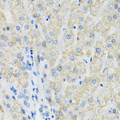 SLC19A1 Antibody - Immunohistochemistry of paraffin-embedded human liver using SLC19A1 antibody at dilution of 1:100 (40x lens).
