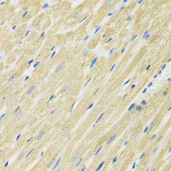 SLC19A1 Antibody - Immunohistochemistry of paraffin-embedded rat heart using SLC19A1 antibody at dilution of 1:100 (40x lens).