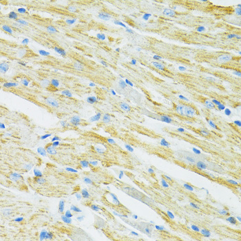 SLC19A1 Antibody - Immunohistochemistry of paraffin-embedded mouse heart using SLC19A1 antibody at dilution of 1:100 (40x lens).