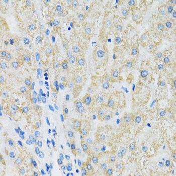 SLC19A1 Antibody - Immunohistochemistry of paraffin-embedded Human liver using SLC19A1 Polyclonal Antibody at dilution of 1:100 (40x lens).
