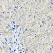 SLC19A1 Antibody - Immunohistochemistry of paraffin-embedded Human liver using SLC19A1 Polyclonal Antibody at dilution of 1:100 (40x lens).